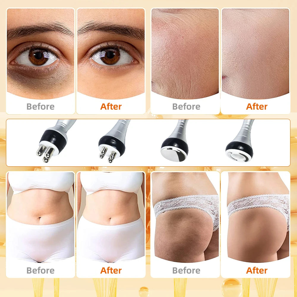 Four-in-one ultrasonic slimming and beauty instrument, 40K beauty massage instrument, skin tightening and lifting vacuum suction